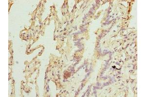 Immunohistochemistry of paraffin-embedded human lung tissue using ABIN7151467 at dilution of 1:100 (TPRKB 抗体  (AA 1-175))