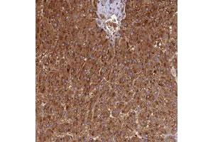 Immunohistochemical staining of human liver with DUS2L polyclonal antibody  shows strong cytoplasmic positivity in hepatocytes. (DUSL2 抗体)