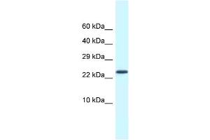 WB Suggested Anti-Csdc2 Antibody   Titration: 1.