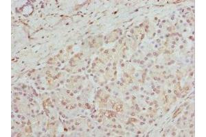 Immunohistochemistry of paraffin-embedded human pancreatic tissue using ABIN7154163 at dilution of 1:100 (GPD2 抗体  (AA 25-325))