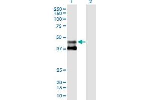 Western Blot analysis of MMAA expression in transfected 293T cell line by MMAA MaxPab polyclonal antibody.