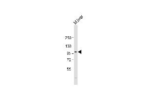 Anti-PROX-1- Antibody at 1:2000 dilution + mouse liver lysate Lysates/proteins at 20 μg per lane. (PROX1 抗体  (AA 492-520))