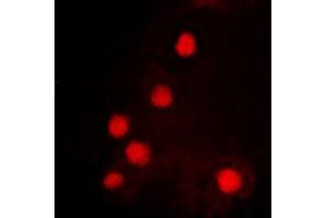 Immunofluorescent analysis of HOXC6 staining in K562 cells. (Homeobox C6 抗体  (C-Term))