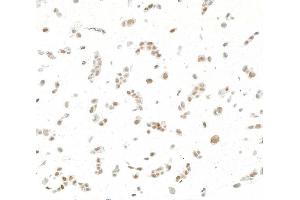 Immunocytochemistry (ICC) image for anti-Jun Dimerization Protein 2 (JDP2) (AA 50-100) antibody (ABIN7795636) (Recombinant JDP2 抗体  (AA 50-100))