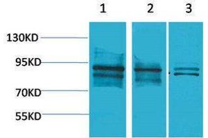 Western Blotting (WB) image for anti-Aryl Hydrocarbon Receptor Nuclear Translocator (ARNT) antibody (ABIN3181520) (ARNT 抗体)