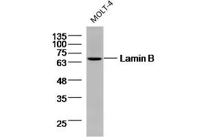 MOLT-4 cell lysates probed with Lamin B (9C11) Monoclonal Antibody, unconjugated (bsm-33040M) at 1:300 overnight at 4°C followed by a conjugated secondary antibody for 60 minutes at 37°C. (Lamin B 抗体)
