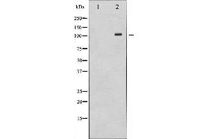 Retinoblastoma 1 抗体  (C-Term)