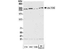 anti-Cytoskeleton Associated Protein 5 (CKAP5) (AA 1982-2032) antibody