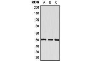 Western blot analysis of EEF1G expression in HeLa (A), HepG2 (B), HL60 (C) whole cell lysates. (EEF1G 抗体  (Center))