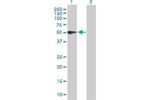 Western Blot analysis of PSG3 expression in transfected 293T cell line by PSG3 MaxPab polyclonal antibody. (PSG3 抗体  (AA 1-428))