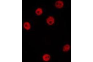 ABIN6277208 staining Hela by IF/ICC. (Histone Cluster 2, H4a (HIST2H4A) (Lys20) 抗体)