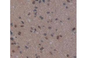 IHC-P analysis of Human Tissue, with DAB staining. (REPIN1 抗体  (AA 57-314))