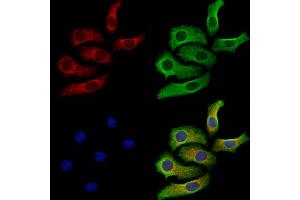 ABIN7094771 and ABIN7098822 staining Hela cells by IF/ICC.