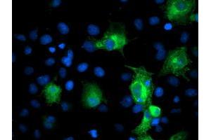Anti-PFKP mouse monoclonal antibody (ABIN2455337) immunofluorescent staining of COS7 cells transiently transfected by pCMV6-ENTRY PFKP (RC200673). (PFKP 抗体)