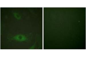 Immunofluorescence analysis of HeLa cells treated with TNF-a 20nM 15', using c-PLA2 (Phospho-Ser505) Antibody. (C-PLA2 (AA 471-520), (pSer505) 抗体)