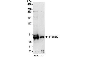 Western Blotting (WB) image for anti-Ribosomal Protein S6 Kinase, 70kDa, Polypeptide 1 (RPS6KB1) (C-Term) antibody (ABIN7449265)