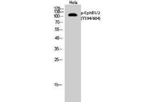 Western Blotting (WB) image for anti-EPH Receptor B1/2 (EPHB1/2) (pTyr594), (pTyr604) antibody (ABIN3182439) (EPHB1/2 抗体  (pTyr594, pTyr604))