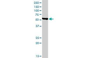CHRDL1 MaxPab rabbit polyclonal antibody. (CHRDL1 抗体  (AA 1-450))
