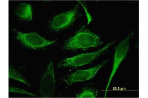 Immunofluorescence of monoclonal antibody to TMSB4Y on HeLa cell. (TMSB4Y 抗体  (AA 1-44))