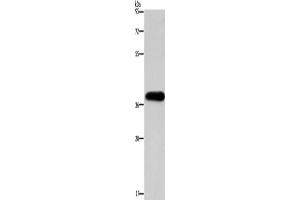 Western Blotting (WB) image for anti-Paired-Like Homeodomain 2 (PITX2) antibody (ABIN2422773) (PITX2 抗体)