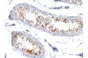 Formalin-fixed, paraffin-embedded human Testis stained with Melan-A / MART-1 Mouse Monoclonal Antibody (MLANA/788). (MLANA 抗体)