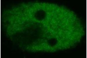 Confocal microscopy of human HeLa cells using anti-p53 (BP53-12 ; FITC). (p53 抗体)