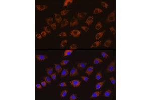 Immunofluorescence analysis of L929 cells using DLG1 Rabbit pAb (ABIN6130273, ABIN6139646, ABIN6139648 and ABIN6224636) at dilution of 1:100 (40x lens). (DLG1 抗体  (AA 1-190))