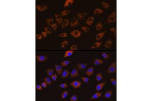 Immunofluorescence analysis of L929 cells using DLG1 Rabbit pAb (ABIN6130273, ABIN6139646, ABIN6139648 and ABIN6224636) at dilution of 1:100 (40x lens). (DLG1 抗体  (AA 1-190))