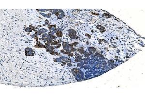 IHC analysis of TMPRSS3 using anti-TMPRSS3 antibody (ABIN7601198). (TMPRSS3 抗体  (AA 3-454))