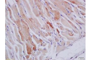 Formalin-fixed and paraffin embedded mouse stomach muscle labeled with Anti-HSPB7 Polyclonal Antibody, Unconjugated (ABIN1387071) at 1:200 followed by conjugation to the secondary antibody and DAB staining (HSPB7 抗体  (AA 135-170))