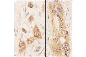 Immunohistochemistry (IHC) image for anti-serine threonine Kinase 39 (STK39) (AA 375-425) antibody (ABIN7453840) (STK39 抗体  (AA 375-425))