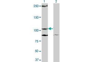 Western Blot analysis of KIT expression in transfected 293T cell line by KIT monoclonal antibody (M08), clone 2C3. (KIT 抗体  (AA 41-140))