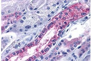 Anti-CXCR7 antibody  ABIN1048486 IHC staining of human kidney, renal tubule.