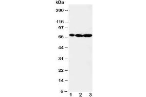 Western blot testing of MEKK2 antibody and Lane 1:  rat brain;  2: rat testis;  3: rat lung tissue lysate (MAP3K2 抗体  (C-Term))