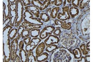 ABIN6274024 at 1/100 staining Rat kidney tissue by IHC-P. (MHC, Class I 抗体)