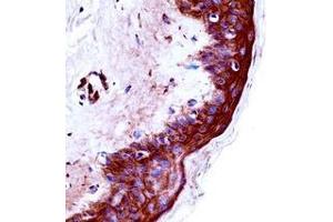 Immunohistochemistry analysis in formalin fixed and paraffin embedded human skin tissue reacted with KLK9 / Kallikrein-9 Antibody (Center) followed by peroxidase conjugation of the secondary antibody and DAB staining.