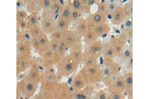 Used in DAB staining on fromalin fixed paraffin-embedded liver tissue (LECT2 抗体  (AA 1-151))