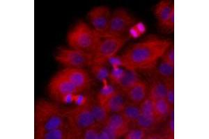Immunofluorescenitrocellulosee of HaCaT cells stained with Hoechst 3342 (Blue) for nucleus staining and monoclonal anti-human beta-Tubulin antibody (1:1000) with Texas Red (Red). (TUBB 抗体  (AA 1-445))