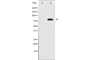Western Blotting (WB) image for anti-BMX Non-Receptor Tyrosine Kinase (BMX) (C-Term) antibody (ABIN6261616)