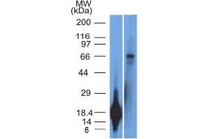 Western Blot Analysis of TRIM29 Recombinant protein fragment & A431 cell lysate TRIM29 Monoclonal Antibody (TRIM29/1042). (TRIM29 抗体  (AA 1-200))