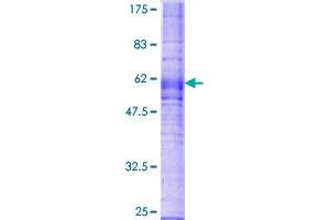 CX3CR1 Protein (AA 1-355) (GST tag)