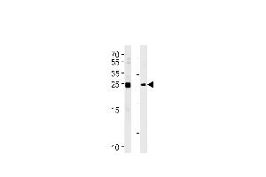 MOB4A Antibody (C-term) (ABIN391030 and ABIN2841198) western blot analysis in Daudi,K562 cell line lysates (35 μg/lane). (MOBKL1A 抗体  (C-Term))