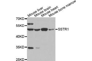 Western blot analysis of extracts of various tissues, using SSTR1 antibody. (SSTR1 抗体)