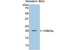 Detection of Recombinant NME2, Mouse using Polyclonal Antibody to Non Metastatic Cells 2, Protein NM23B Expressed In (NME2) (NME2 抗体  (AA 8-149))