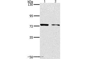 Western blot analysis of MCF7 and hela cell, using PPP1R13L Polyclonal Antibody at dilution of 1:500 (PPP1R13L 抗体)