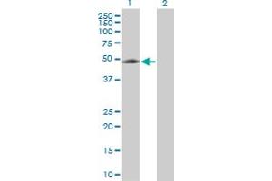 Western Blot analysis of EIF5 expression in transfected 293T cell line by EIF5 MaxPab rabbit polyclonal antibody. (EIF5 抗体  (AA 1-431))