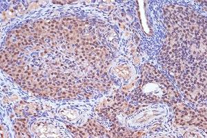 Immunohistochemistry of paraffin-embedded rat ovary using MSH2 Rabbit mAb (ABIN7268547) at dilution of 1:100 (40x lens). (MSH2 抗体)