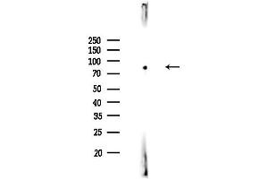 anti-Regulatory Factor X 3 (RFX3) (C-Term) antibody