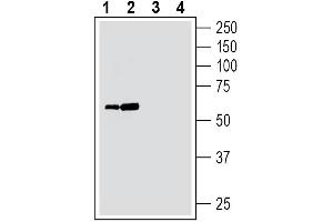 anti-Solute Carrier Family 39 (Zinc Transporter), Member 14 (SLC39A14) (AA 264-278), (Intracellular) antibody
