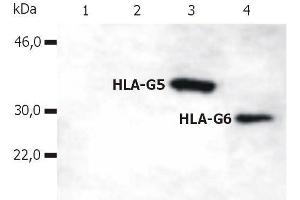 Western Blotting analysis of whole cell lysate of HLA-G stable transfectants (various splice variants) using anti-human HLA-G (5A6G7). (HLAG 抗体  (C-Term) (PE))